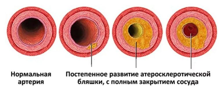 Как быстро поднять потенцию перед самым половым актом?